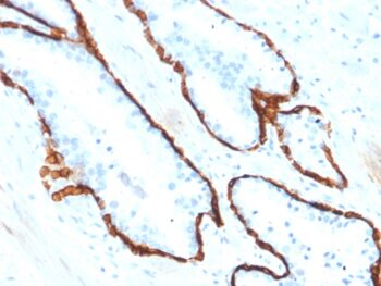 Cytokeratin 15 (Esophageal Squamous Cell Carcinoma Marker)(KRT15/2554), CF405S conjugate, 0.1mg/mL