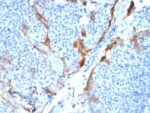 Cytokeratin 16 (KRT16) (Suprabasal Keratinocyte Marker)(KRT16/1714), CF594 conjugate, 0.1mg/mL