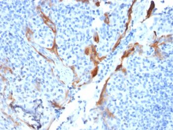 Cytokeratin 16 (KRT16) (Suprabasal Keratinocyte Marker)(KRT16/1714), CF594 conjugate, 0.1mg/mL