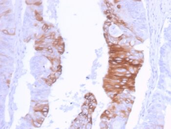 Cytokeratin 20 (KRT20) (Colorectal Epithelial Marker)(KRT20/3129R), Biotin conjugate, 0.1mg/mL