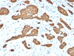 Cytokeratin 8 (KRT8)(KRT8/2115), CF568 conjugate, 0.1mg/mL 1 view_image-535