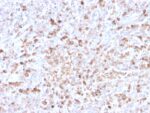 Human Lambda Light Chain (B-Cell Marker)(LLC/3778R), CF640R conjugate, 0.1mg/mL