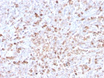 Human Lambda Light Chain (B-Cell Marker)(LLC/3778R), CF640R conjugate, 0.1mg/mL