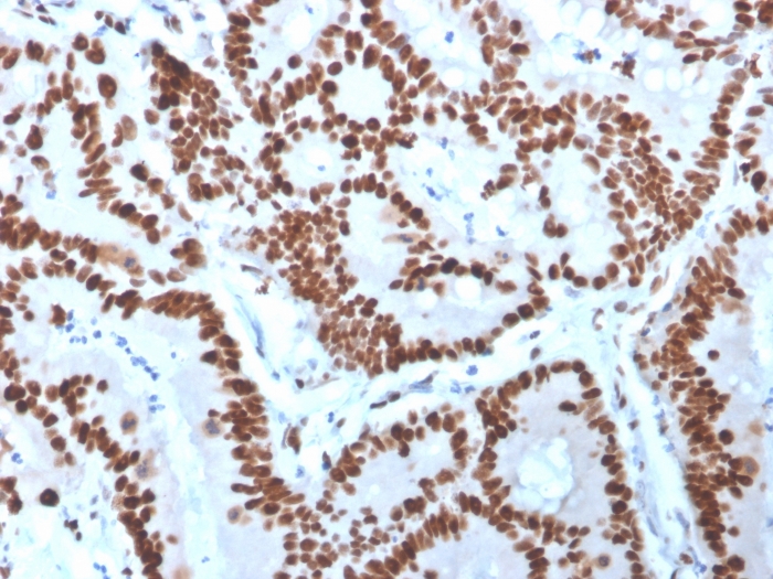 view_image-560 view image 560- Immunomart