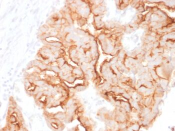 MUC16 / CA125 (Ovarian Carcinoma Marker)(MUC16/1860), Biotin conjugate, 0.1mg/mL