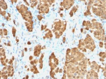 S100B (Astrocyte and Melanoma Marker) (S100B/1706R), CF568 conjugate, 0.1mg/mL