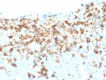 NGF-Receptor (p75) / CD271 (Soft Tissue Tumor Marker) (NGFR/1964), CF488A conjugate, 0.1mg/mL