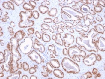 NKX3.1 (Metastatic Prostate Adenocarcinoma Marker)(NKX3.1/2836), CF740 conjugate, 0.1mg/mL