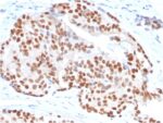 NKX3.1 (Metastatic Prostate Adenocarcinoma Marker)(NKX3.1/3347), CF568 conjugate, 0.1mg/mL