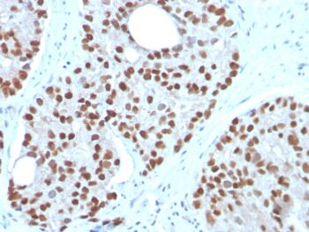 NKX3.1 (Metastatic Prostate Adenocarcinoma Marker)(NKX3.1/3350), CF594 conjugate, 0.1mg/mL