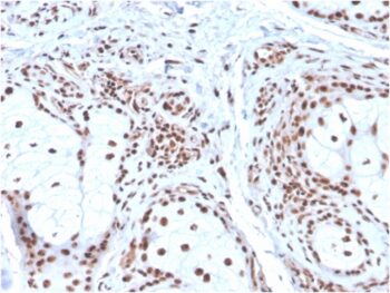 Nucleophosmin (Acute Myeloid Leukemia Marker)(NPM1/3286), 0.2mg/mL