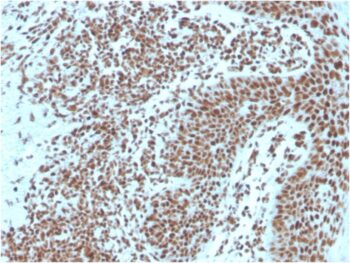 Nucleophosmin (Acute Myeloid Leukemia Marker)(NPM1/3287), CF740 conjugate, 0.1mg/mL