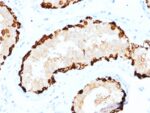 Melanoma Antigen Family A, 4 / MAGEA4(CPTC-MAGEA4-1), Biotin conjugate, 0.1mg/mL 1 view_image-66-1