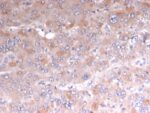 Adipophilin / Perilipin-2 (Marker of Lipid Accumulation)(rADFP/1493), CF594 conjugate, 0.1mg/mL