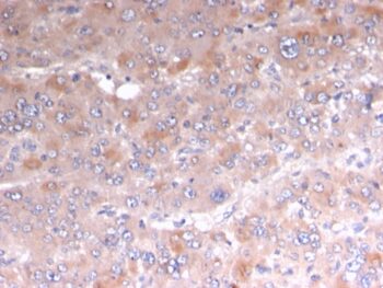 Adipophilin / Perilipin-2 (Marker of Lipid Accumulation)(rADFP/1493), CF594 conjugate, 0.1mg/mL