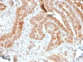 AKT1 (Prognostic Marker for Neuroendocrine Tumors)(rAKT1/2491), CF488A conjugate, 0.1mg/mL