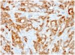 Beta-2 Microglobulin (Renal Failure &Tumor Marker) (rB2M/961), CF405S conjugate, 0.1mg/mL