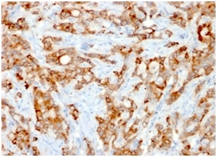 Beta-2 Microglobulin (Renal Failure &Tumor Marker) (rB2M/961), CF405S conjugate, 0.1mg/mL