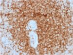 Bcl-2 (Apoptosis & Follicular Lymphoma Marker) (rBCL2/796), CF594 conjugate, 0.1mg/mL