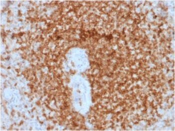 Bcl-2 (Apoptosis & Follicular Lymphoma Marker) (rBCL2/796), CF594 conjugate, 0.1mg/mL