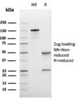 Bcl-6 (Follicular Lymphoma Marker)(rBCL6/1475), CF405S conjugate, 0.1mg/mL