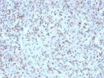 Bcl-6 (Follicular Lymphoma Marker) (rBCL6/1527), 0.2mg/mL