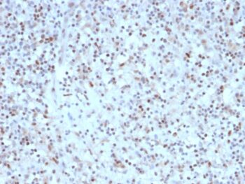 Bcl-6 (Follicular Lymphoma Marker) (rBCL6/1527), 0.2mg/mL