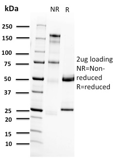RET Proto-oncogene(RET/2662), 0.2mg/mL