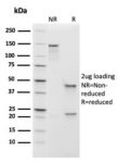 Human IgM (Immunoglobulin Mu Heavy Chain) (B-Cell Marker)(rIGHM/1623), CF594 conjugate, 0.1mg/mL