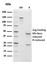 Human IgM (Immunoglobulin Mu Heavy Chain) (B-Cell Marker)(rIGHM/1623), CF594 conjugate, 0.1mg/mL