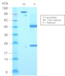 Human IgM (Immunoglobulin Mu Heavy Chain) (B-Cell Marker)(rIGHM/2558), Biotin conjugate, 0.1mg/mL