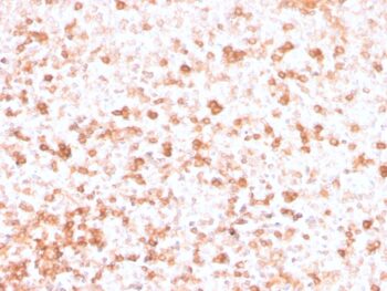 Human Lambda Light Chain (B-Cell Marker)(rLLC/3777), CF594 conjugate, 0.1mg/mL