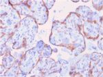 MMP3 (Marker of Metastasis and Rheumatoid Arthritis)(rMMP3/1730), CF640R conjugate, 0.1mg/mL