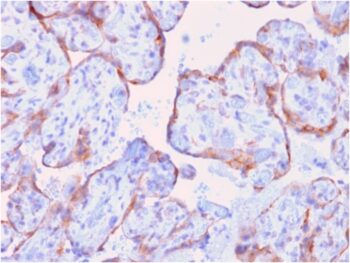MMP3 (Marker of Metastasis and Rheumatoid Arthritis)(rMMP3/1730), CF640R conjugate, 0.1mg/mL