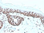 Nucleophosmin (Acute Myeloid Leukemia Marker)(rNPM1/1901), Biotin conjugate, 0.1mg/mL 1 view_image-786