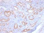 TTF-1 / NKX2.1 (Thyroid & Lung Epithelial Marker) (rNX2.1/690), CF405S conjugate, 0.1mg/mL