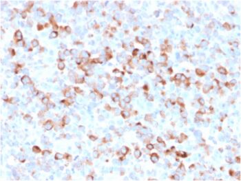 Tyrosinase (Melanoma Marker)(rOCA1/812), 1mg/mL