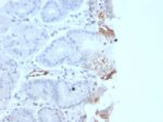von Willebrand Factor / Factor VIII Related-Ag (Endothelial Marker)(rVWF/2480), 0.2mg/mL