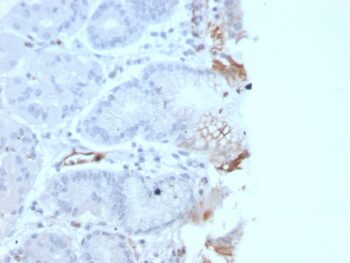 von Willebrand Factor / Factor VIII Related-Ag (Endothelial Marker)(rVWF/2480), 0.2mg/mL