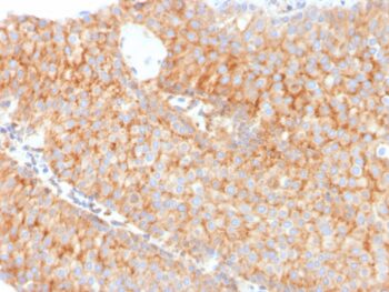 PAI-RBP1 / SERBP1 / SERPINE1(SERBP1/3491), CF405S conjugate, 0.1mg/mL