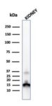 Transthyretin (Prealbumin)(CPTC-TTR-1), 0.2mg/mL 1 view_image-82-1