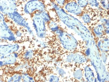 Spectrin Alpha 1 (Erythrocyte Marker) (SPTA1/1810), 0.2mg/mL