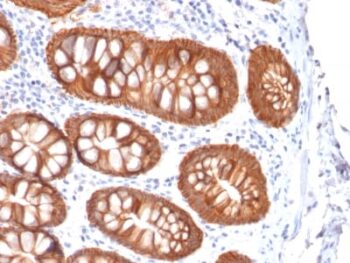 Ep-CAM / CD326 (Epithelial Marker) (rVU-1D9), 1mg/mL