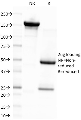 Epstein-Barr Virus (LMP-1)(CS4), CF740 conjugate, 0.1mg/mL