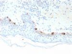 Tyrosinase-Related Protein-1 (TYRP-1) (Melanoma Marker)(TYRP1/3281), 0.2mg/mL 1 view_image-900
