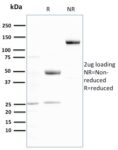 Ubiquitin (Autophagy Marker)(UBB/3143R), CF740 conjugate, 0.1mg/mL 1 view_image-905