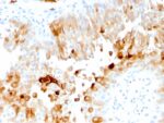 Uroplakin 1A (Urothelial Differentiation Marker)(UPK1A/2921), 1mg/mL