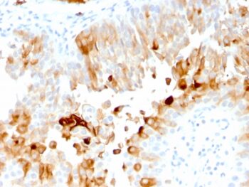 Uroplakin 1A (Urothelial Differentiation Marker)(UPK1A/2921), 1mg/mL