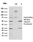 Uroplakin 1A (Urothelial Differentiation Marker)(UPK1A/2924), 0.2mg/mL