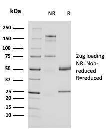 Uroplakin 1A (Urothelial Differentiation Marker)(UPK1A/2924), 0.2mg/mL